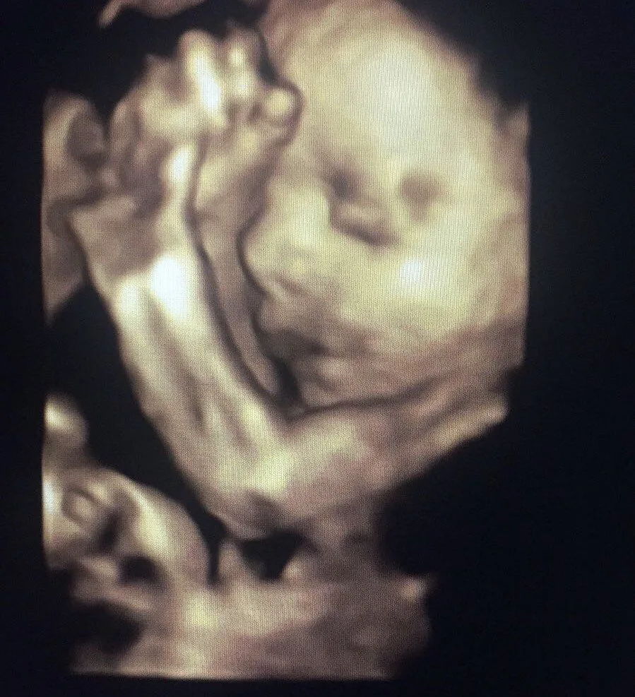 Baby scan image 8