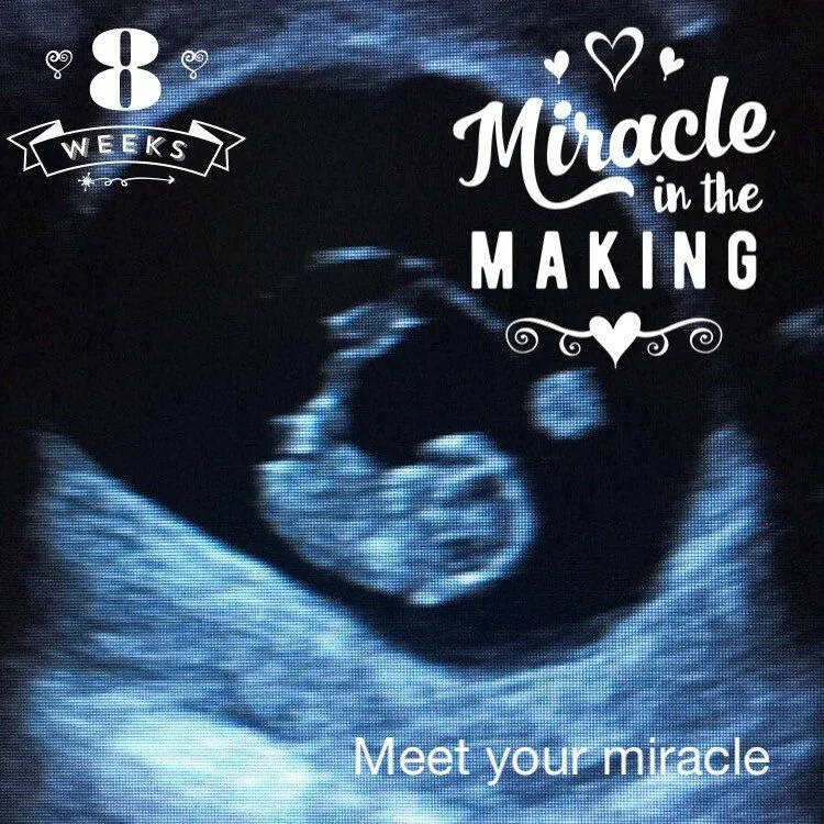 Baby scan image 13