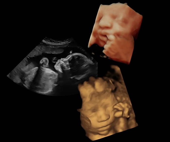 Premium Bundle x3 scan Package £220